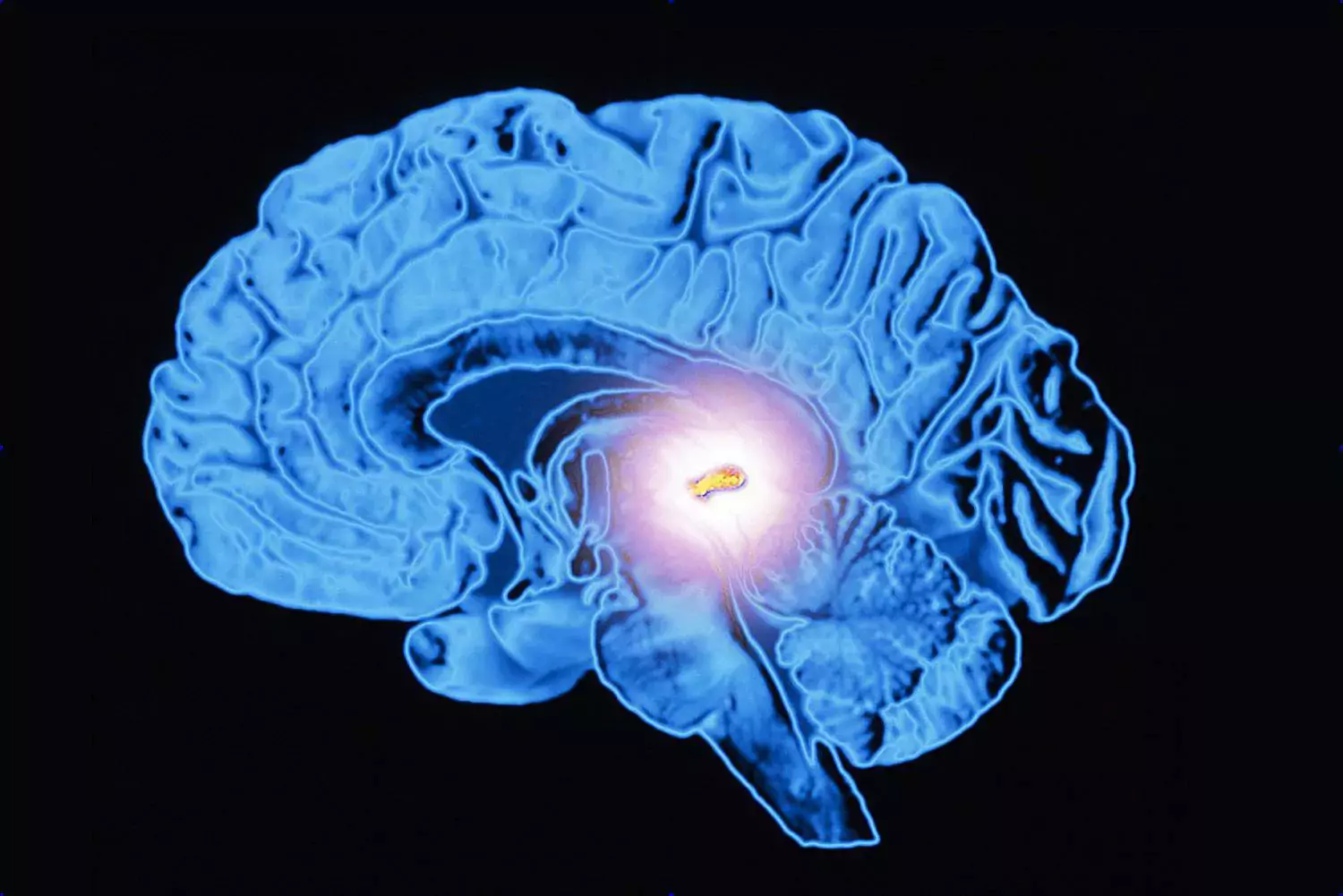 use of pineal guardian